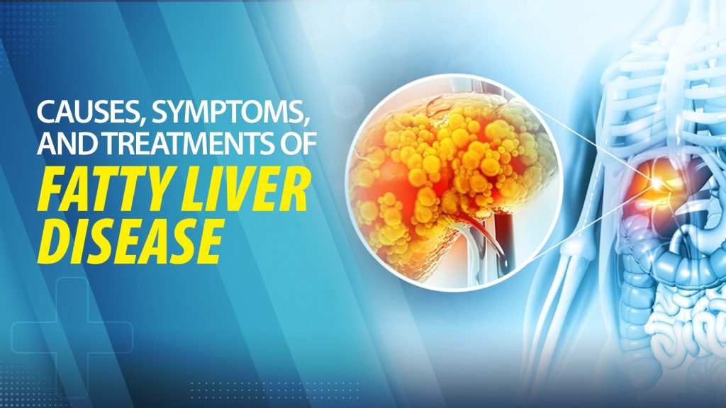 What Are the Causes, Symptoms, and Treatments of Fatty Liver Disease?